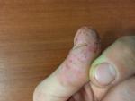 Палец руки фото 3