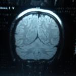 МРТ головного мозга, помогите, пожалуйста фото 2
