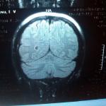 МРТ головного мозга, помогите, пожалуйста фото 4