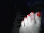 Покраснение на пальце ноги фото 1
