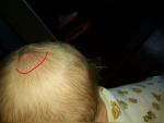 Пятнышко на голове ребенка фото 2