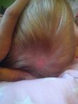 Лысое пятно на голове ребенка фото 2