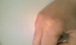 Подвижное Уплотнение на сухожилии среднего пальца фото 1
