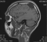 Снимок МРТ головы фото 2