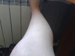 Странное состояние кожи на ногах фото 1