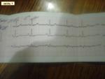 Расшифруйте кардиограмму, болит серце фото 1