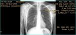 Описание рентгена легких фото 1