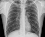Вопрос по рентгену грудной клетки фото 2