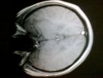 Не ясны результаты МРТ головного мозга и узи сосудов фото 1