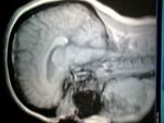 Не ясны результаты МРТ головного мозга и узи сосудов фото 2