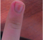 Палец фото 1