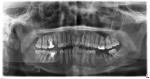 Расшифровка панорамного снимка зубов фото 1