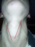 Болит горло слева и увелечены лимфоузлы фото 5