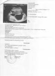 Медикаментозный аборт при кисте яичника фото 1