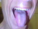Красное пятно на языке и боли в животе фото 1