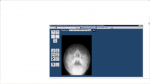 Комментарии описания рентгена придаточных пазух носа фото 2