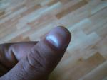 Волнистость на ногтях больших пальцах рук фото 3