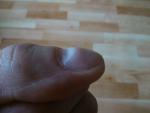 Волнистость на ногтях больших пальцах рук фото 4