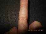 Травма пальца руки фото 1