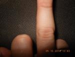 Травма пальца руки фото 4