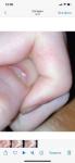 Бело пятно на ногте руки фото 1