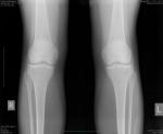 Боль в колене мрт и рентген фото 1