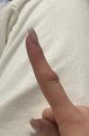 Увеличен сустав указательного пальца фото 2