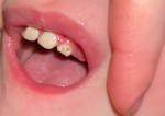 Что с зубами у ребёнка? фото 1