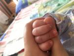 Прыщики на пальцах у младенца фото 2