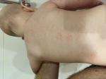 Появились шершавые пятна на спине дочери после курса массажа фото 2