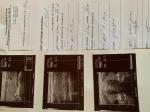 Планирование беременности, завышены гормоны фото 4
