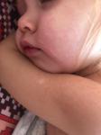 Сыпь и температура у ребенка фото 5