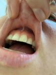 Проблемы слизистой рта фото 5