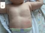 Деформация грудной клетки у ребёнка? фото 3