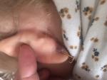 Шишка на мочке уха у ребенка фото 3