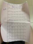 Расшифровка кардиограммы, боли в сердце фото 1