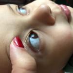 Пятно на белке глаза у ребенка фото 1
