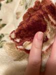 Красные продольные полосы на ногтях после покрытия гель-лаком фото 1