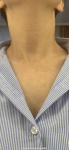 Мышцы шеи или лимфоузел фото 1