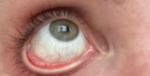 Пожелтение белков глаз и боли в правом подреберье фото 3