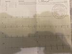 Расшифровка кардиограммы, женщина 58 лет после коронавируса фото 1