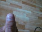 Волнистость на ногтях больших пальцах рук фото 1