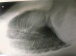 Рентген снимки легких в 2х проекциях фото 2