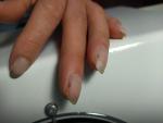 Грибок ногтей после маникюра фото 1