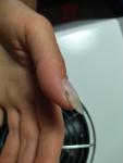 Грибок ногтей после маникюра фото 2