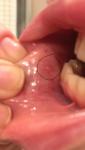 Единичные мелкие пузырьки во рту фото 2