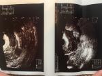 Задержка менструального цикла при кисте яичника и отсутствии беременности фото 1