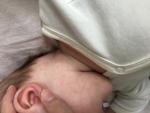Появилась сыпь у ребёнка на шее и плечах фото 2