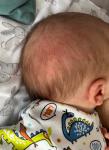 Акне новорожденного или аллергия (фото) фото 4