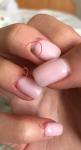 Коричневые высыпания в лунках ногтей после маникюра фото 1
